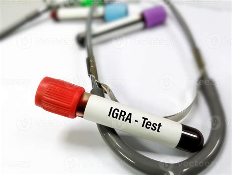 exame igra - exame de sangue o que detecta